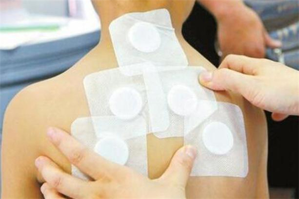 三伏貼多少錢一個療程 三伏貼一般多少錢 三伏貼多少錢一個療程 三伏貼一般多少錢