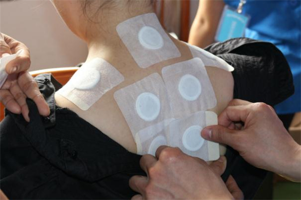 三伏貼多少錢一個療程 三伏貼一般多少錢 三伏貼多少錢一個療程 三伏貼一般多少錢