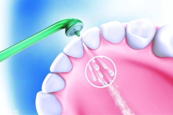 牙結(jié)石一定要洗牙嗎 自己如何去除牙結(jié)石 牙結(jié)石一定要洗牙嗎 自己如何去除牙結(jié)石