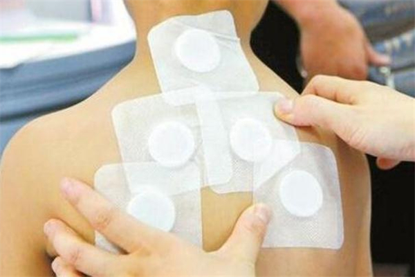 三伏貼錯(cuò)過(guò)了初伏還能貼嗎 三伏貼錯(cuò)過(guò)了頭伏怎么辦 三伏貼錯(cuò)過(guò)了初伏還能貼嗎 三伏貼錯(cuò)過(guò)了頭伏怎么辦