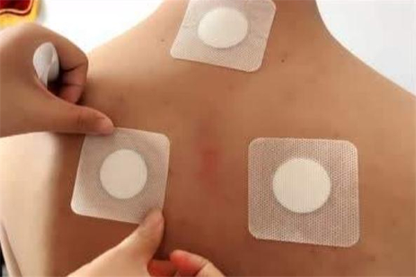 貼三伏貼為什么要忌口 三伏貼要忌口哪些食物 貼三伏貼為什么要忌口 三伏貼要忌口哪些食物