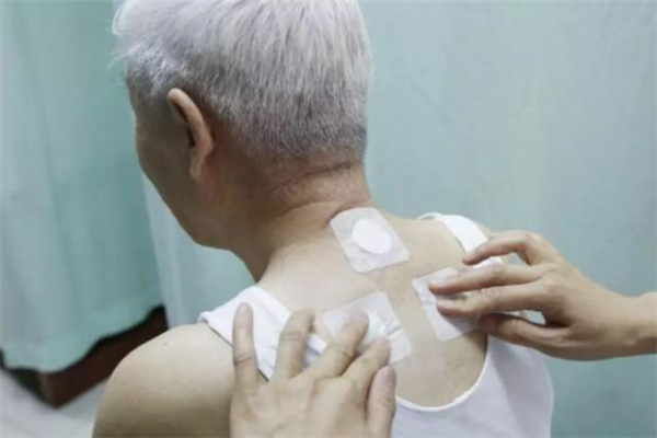 三伏貼可以貼著睡覺嗎 睡覺可以貼三伏貼嗎 三伏貼可以貼著睡覺嗎 睡覺可以貼三伏貼嗎