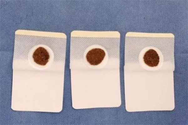 貼三伏貼會推遲月經(jīng)嗎 貼三伏貼會影響月經(jīng)嗎 貼三伏貼會推遲月經(jīng)嗎 貼三伏貼會影響月經(jīng)嗎