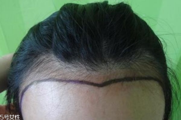 夏季應(yīng)該怎么樣扎丸子頭 半丸子頭 夏季應(yīng)該怎么樣扎丸子頭 半丸子頭