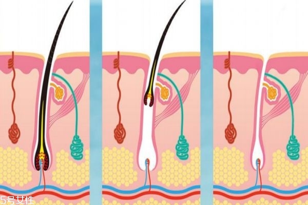女性吃牛肉會容易長胡子嗎 女性吃什么容易長胡子 女性吃牛肉會容易長胡子嗎 女性吃什么容易長胡子
