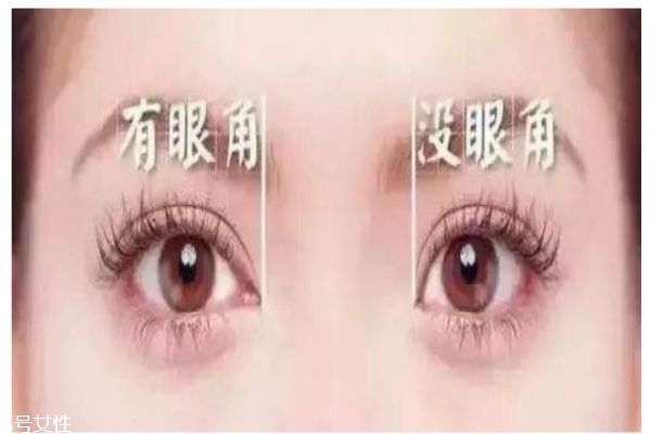 開眼角的好處是什么呢 開眼角需要注意什么呢 開眼角的好處是什么呢 開眼角需要注意什么呢
