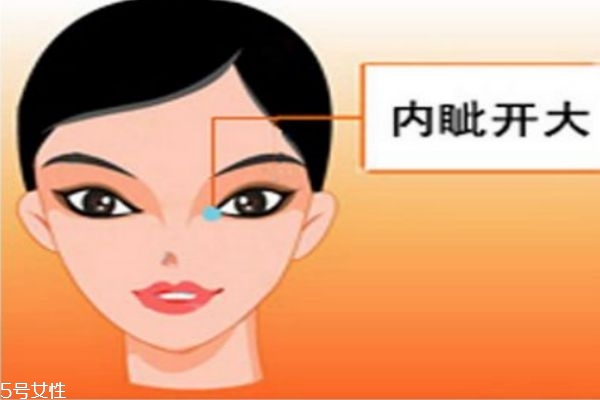 開眼角的好處是什么呢 開眼角需要注意什么呢 開眼角的好處是什么呢 開眼角需要注意什么呢