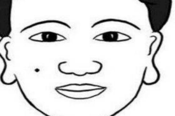 點(diǎn)痣后的注意事項(xiàng)有什么 點(diǎn)痣的方法有什么 點(diǎn)痣后的注意事項(xiàng)有什么 點(diǎn)痣的方法有什么