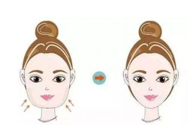 面部吸脂是什么 面部吸脂有什么用 面部吸脂是什么 面部吸脂有什么用