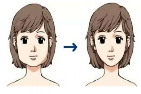 瘦臉針有副作用嗎 瘦臉針的價格是多少 瘦臉針有副作用嗎 瘦臉針的價格是多少