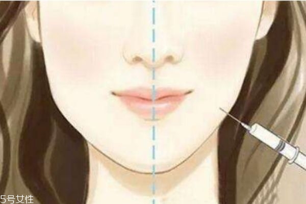 瘦臉針有副作用嗎 瘦臉針的價格是多少 瘦臉針有副作用嗎 瘦臉針的價格是多少