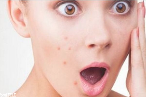 芙清凝膠怎么使用 芙清凝膠白天可以用嗎 芙清凝膠怎么使用 芙清凝膠白天可以用嗎