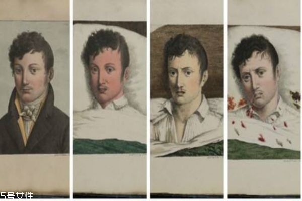 什么是黃熱病 黃熱病有什么癥狀呢 什么是黃熱病 黃熱病有什么癥狀呢