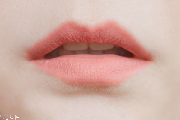唇色深的人怎么改善 唇色深的原因 唇色深的人怎么改善 唇色深的原因