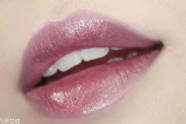 唇色深的人怎么改善 唇色深的原因 唇色深的人怎么改善 唇色深的原因
