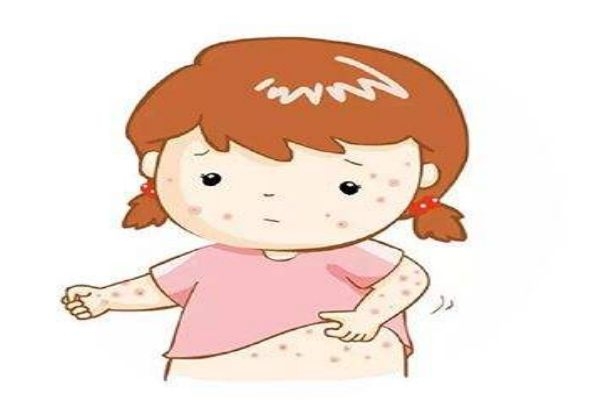 什么是濕疹呢 濕疹有什么危害呢 什么是濕疹呢 濕疹有什么危害呢