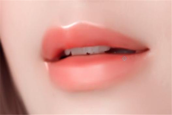 嘟嘟唇會(huì)腫幾天能消腫 嘟嘟唇豐唇保持多久 嘟嘟唇會(huì)腫幾天能消腫 嘟嘟唇豐唇保持多久