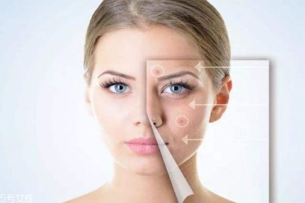 怎樣能使皮膚白嫩細(xì)膩 使皮膚變白嫩細(xì)膩的方法 怎樣能使皮膚白嫩細(xì)膩 使皮膚變白嫩細(xì)膩的方法