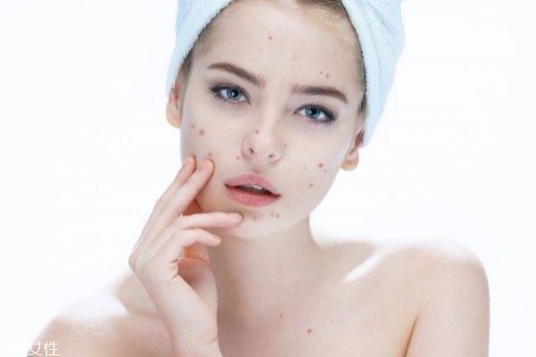 脂肪粒怎么形成的 長了脂肪粒怎么辦 脂肪粒怎么形成的 長了脂肪粒怎么辦