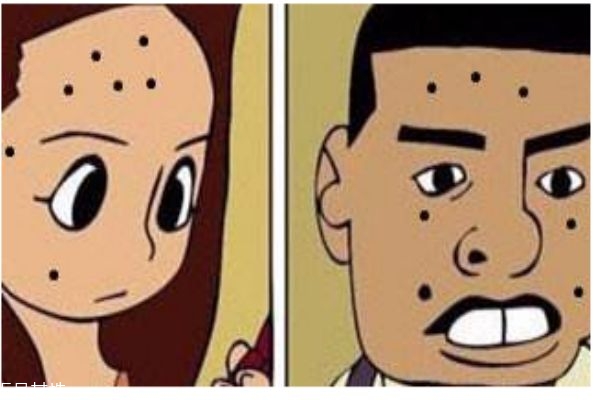 點(diǎn)痣會(huì)留疤嗎 點(diǎn)痣痛嗎 點(diǎn)痣會(huì)留疤嗎 點(diǎn)痣痛嗎