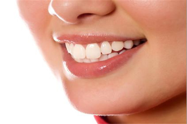 牙齒貼面是什么 牙齒貼面的好處很多 牙齒貼面是什么 牙齒貼面的好處很多