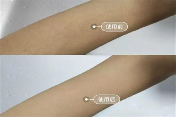 蜜蠟脫毛的壞處是什么 蜜蠟脫毛有什么影響 蜜蠟脫毛的壞處是什么 蜜蠟脫毛有什么影響