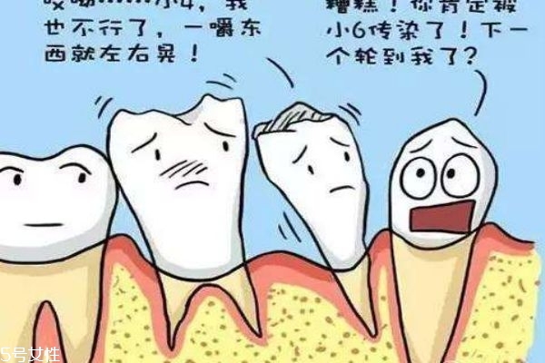 牙齒松動應該怎么辦呢 牙齒為什么會松動呢 牙齒松動應該怎么辦呢 牙齒為什么會松動呢