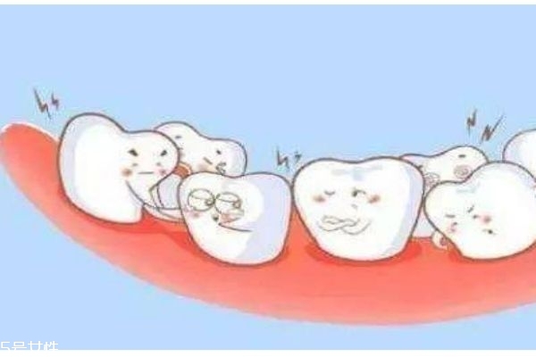 牙齒松動應(yīng)該怎么辦呢 牙齒為什么會松動呢 牙齒松動應(yīng)該怎么辦呢 牙齒為什么會松動呢