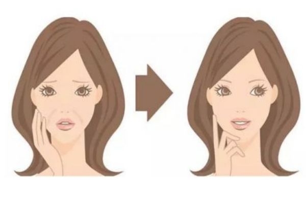 什么是法令紋 法令紋消除方法有什么呢 什么是法令紋 法令紋消除方法有什么呢