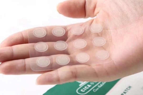 什么樣的痘痘才適合用痘痘貼 痘痘貼的注意事項(xiàng) 什么樣的痘痘才適合用痘痘貼 痘痘貼的注意事項(xiàng)