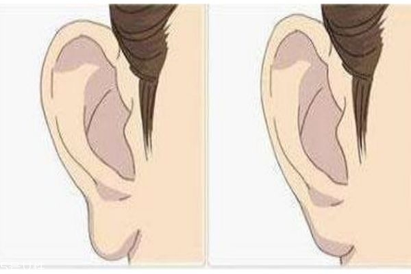 什么是豐耳垂呢 如何豐耳垂呢 什么是豐耳垂呢 如何豐耳垂呢