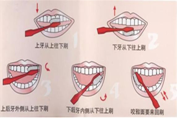 用鹽刷牙的正確方法是什么 用鹽刷牙不能太頻繁 用鹽刷牙的正確方法是什么 用鹽刷牙不能太頻繁