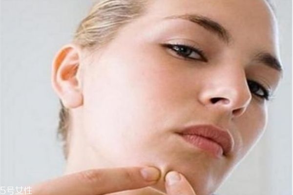 下巴長痘痘怎么辦 下巴長痘痘這樣調理