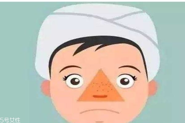 油皮怎么護(hù)膚呢 油皮應(yīng)該用什么產(chǎn)品呢 油皮怎么護(hù)膚呢 油皮應(yīng)該用什么產(chǎn)品呢