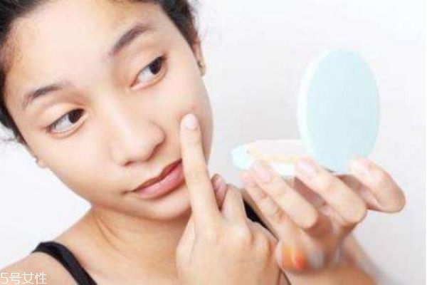 長(zhǎng)了痘痘之后要注意些什么 痘痘去除小竅門(mén)