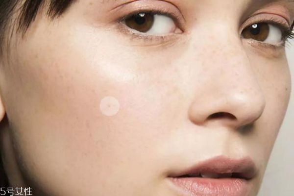 為什么額頭上長很多小痘痘 額頭下巴長痘痘的原因 為什么額頭上長很多小痘痘 額頭下巴長痘痘的原因