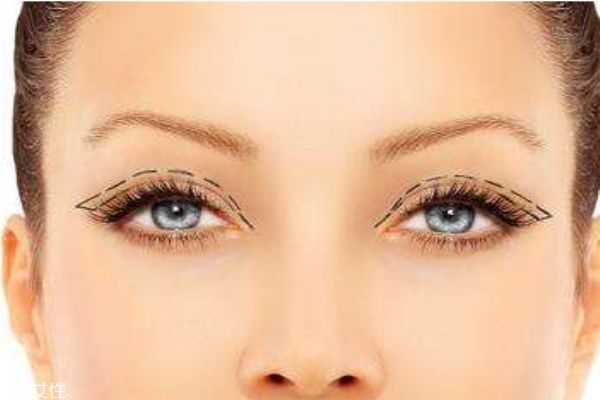 雙眼皮是怎么形成的呢 雙眼皮手術(shù)的工作原理是什么呢 雙眼皮是怎么形成的呢 雙眼皮手術(shù)的工作原理是什么呢