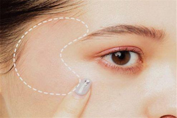 眼角皺紋多是什么原因 眼角皺紋多怎么能消除 眼角皺紋多是什么原因 眼角皺紋多怎么能消除