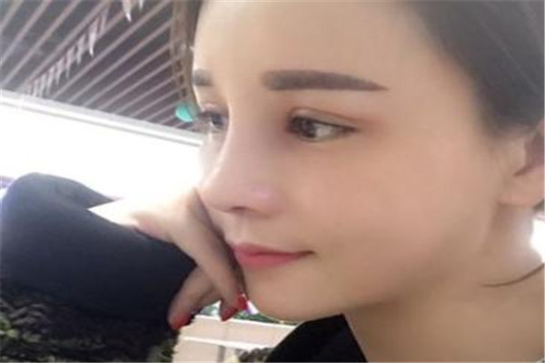 鼻子假體透光怎么辦 需要進(jìn)行遮蓋 鼻子假體透光怎么辦 需要進(jìn)行遮蓋