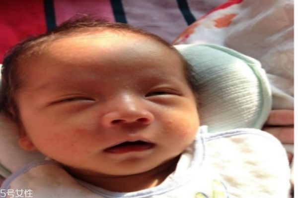 為什么新生兒的皮膚是皺巴巴的呢 新生兒不哭怎么辦呢 為什么新生兒的皮膚是皺巴巴的呢 新生兒不哭怎么辦呢