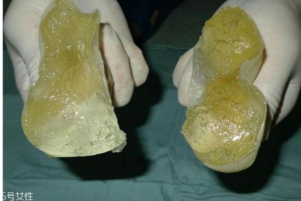 隆胸有什么禁忌人群嗎 隆胸需要注意什么呢 隆胸有什么禁忌人群嗎 隆胸需要注意什么呢