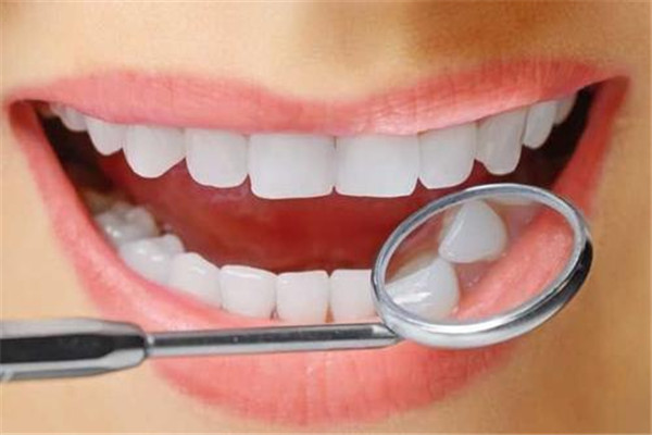 洗牙是自費還是醫(yī)保卡 洗牙價格是多少錢