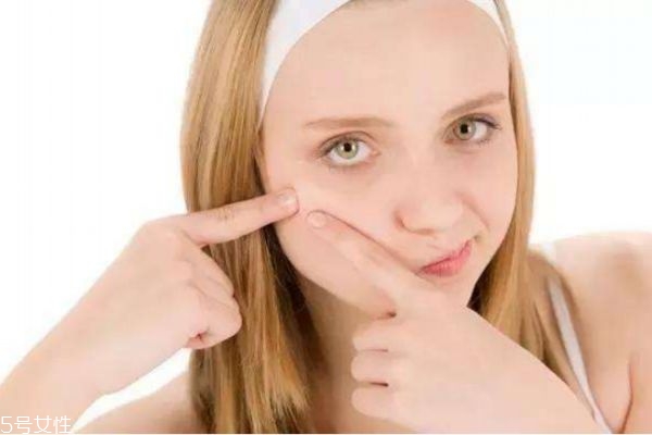 臉上長(zhǎng)痘的原因 長(zhǎng)痘痘原因有這些 臉上長(zhǎng)痘的原因 長(zhǎng)痘痘原因有這些