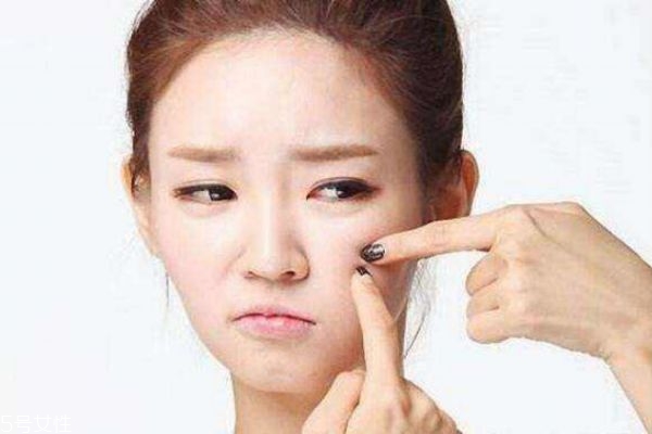 臉上長(zhǎng)痘的原因 長(zhǎng)痘痘原因有這些 臉上長(zhǎng)痘的原因 長(zhǎng)痘痘原因有這些