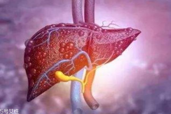 肝不好的人群有什么癥狀呢 肝不好應該怎么辦呢 肝不好的人群有什么癥狀呢 肝不好應該怎么辦呢