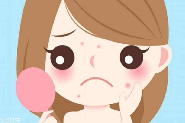 痘印為什么會變黑 紅痘印和黑痘印有什么區(qū)別 痘印為什么會變黑 紅痘印和黑痘印有什么區(qū)別