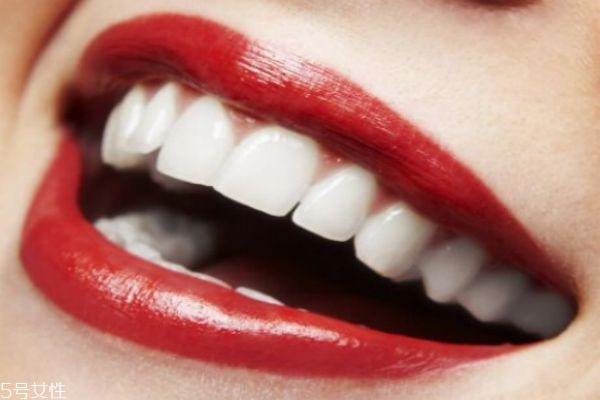 烤瓷牙怎么保養(yǎng) 做烤瓷牙要注意什么 烤瓷牙怎么保養(yǎng) 做烤瓷牙要注意什么