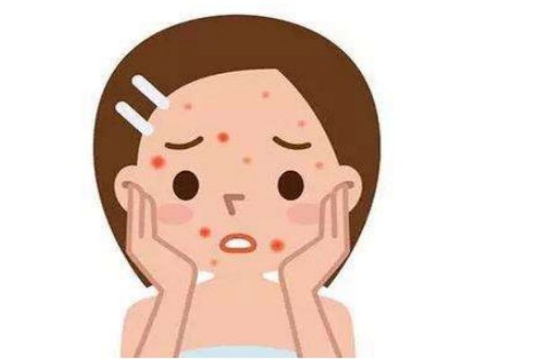 痘印為什么會變黑 紅痘印和黑痘印有什么區(qū)別 痘印為什么會變黑 紅痘印和黑痘印有什么區(qū)別
