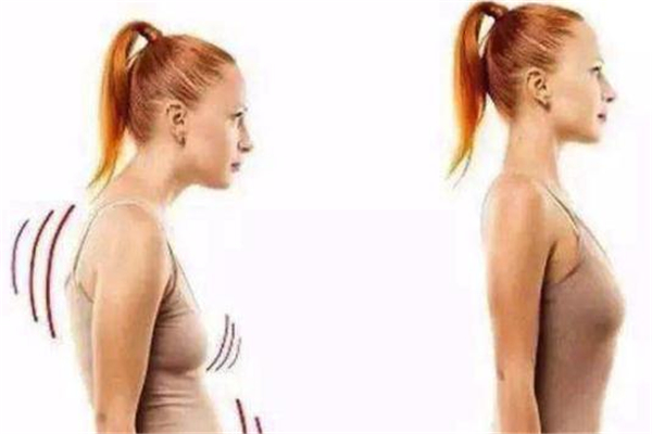 束腰帶可以改善駝背嗎 束腰帶對駝背有用嗎 束腰帶可以改善駝背嗎 束腰帶對駝背有用嗎