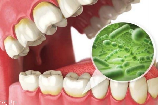 怎么預(yù)防口臭 如何預(yù)防口臭問題 怎么預(yù)防口臭 如何預(yù)防口臭問題